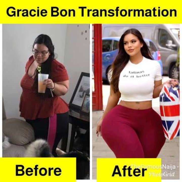 Before Gracie Bon's Surgery: A Look Back
