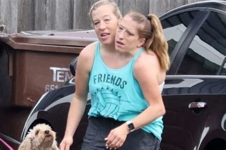 Breaking: Sad News About Abby and Brittany Hensel
