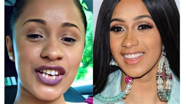 Cardi B Teeth: The Story Behind Her Iconic Smile