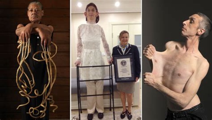 Discovering the Skinniest Man in the World: A Fascinating Journey