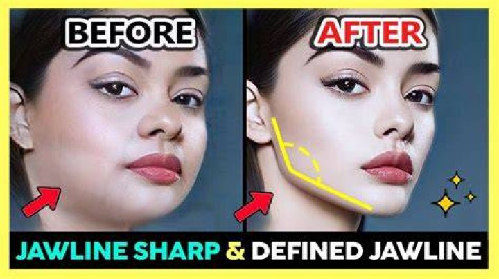 Jawline Exercises Before and After: Transform Your Face Shape with These Powerful Techniques