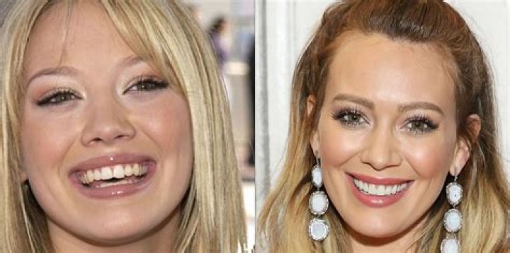 Lydia RHOC Teeth: A Complete Guide to Her Iconic Smile and Journey