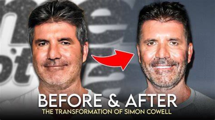 Simon Cowell's Health Condition: The Untold Story