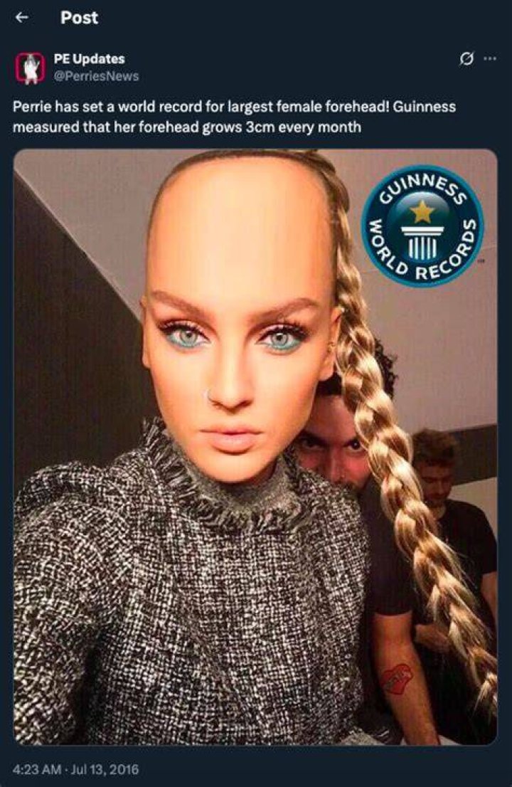 Unbelievable! Biggest Forehead in the World Revealed!