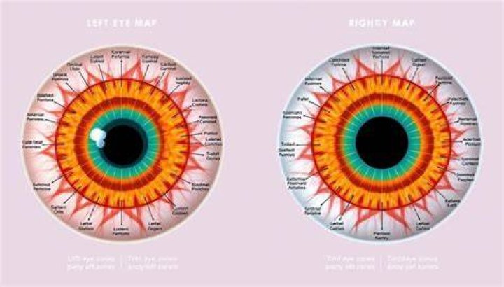 Understanding Left Eye Vision: Insights, Causes, and Solutions