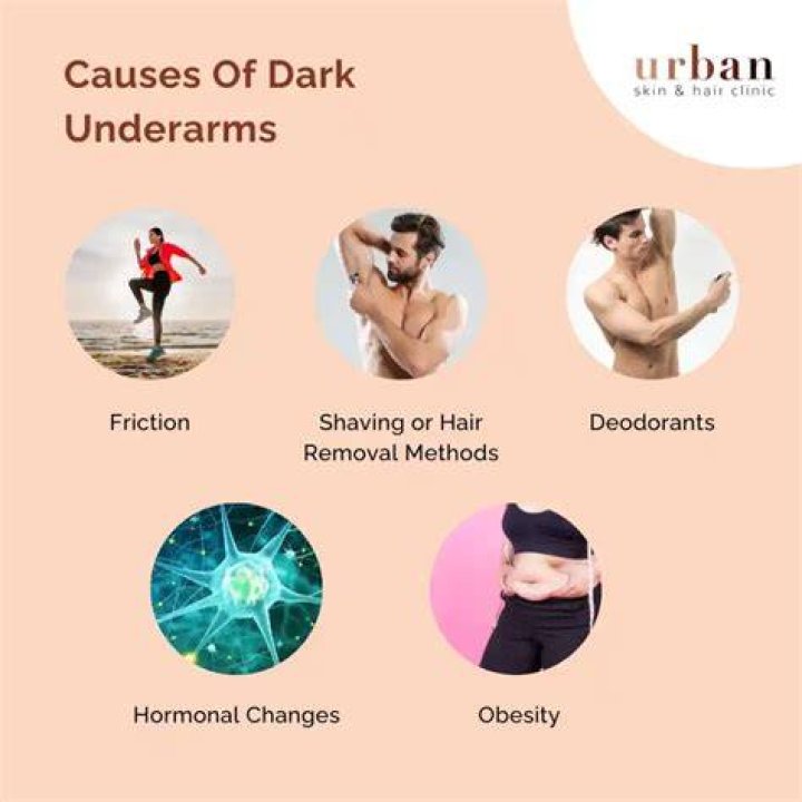 Unveiling the Mystery of Celebrities' Dark Underarms: Causes, Treatments, and Prevention