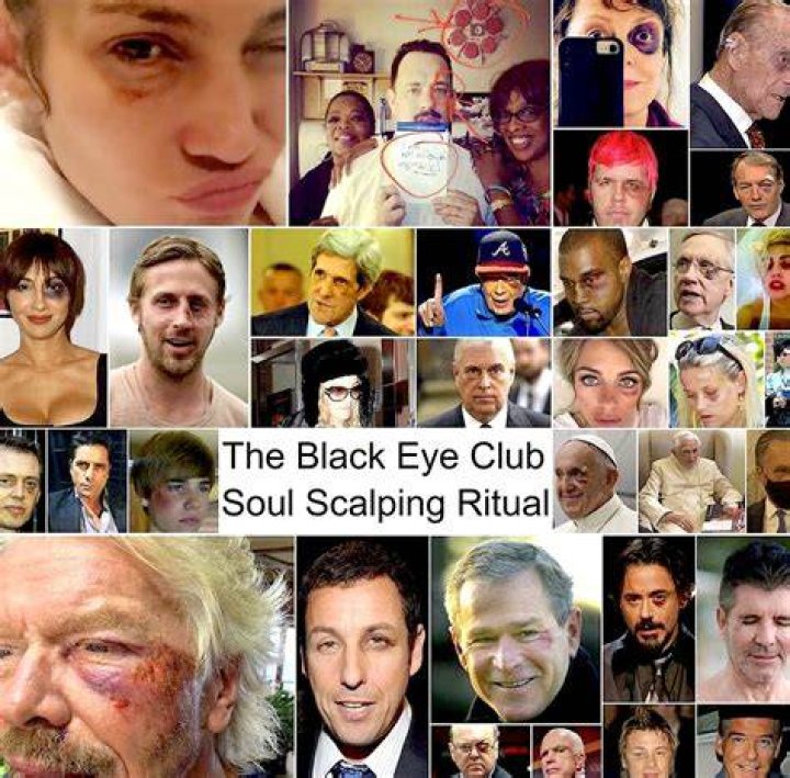 Unveiling the Truth: The Intriguing World of Black Eye Conspiracy